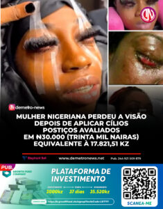 Mulher Nigeriana Perde a Visão Após Aplicação de Cílios Postiços avaliado em 17.821,51 kwanzas